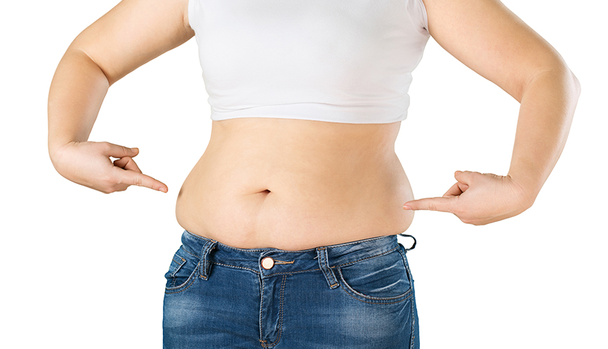 Gastric-Bypass-Fedmeoperation