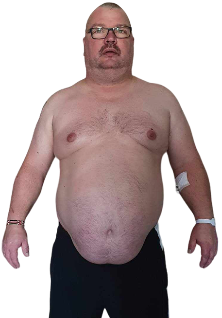 anders-before